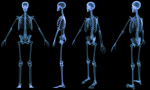 A skeletal xray from 4 diferent views.