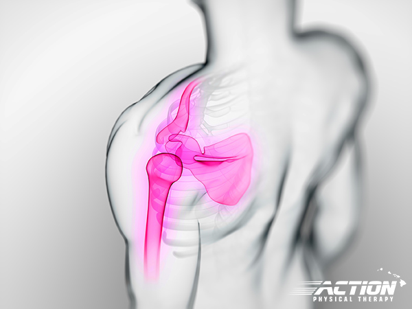  3d rendered scientific illustration of a painful shoulder.
