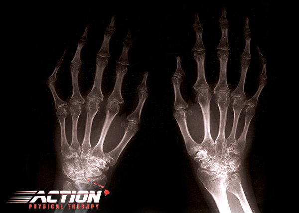 Hand X-Ray